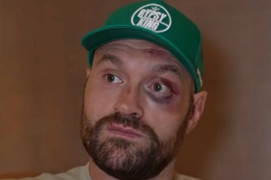 Фото: Boxing King Media