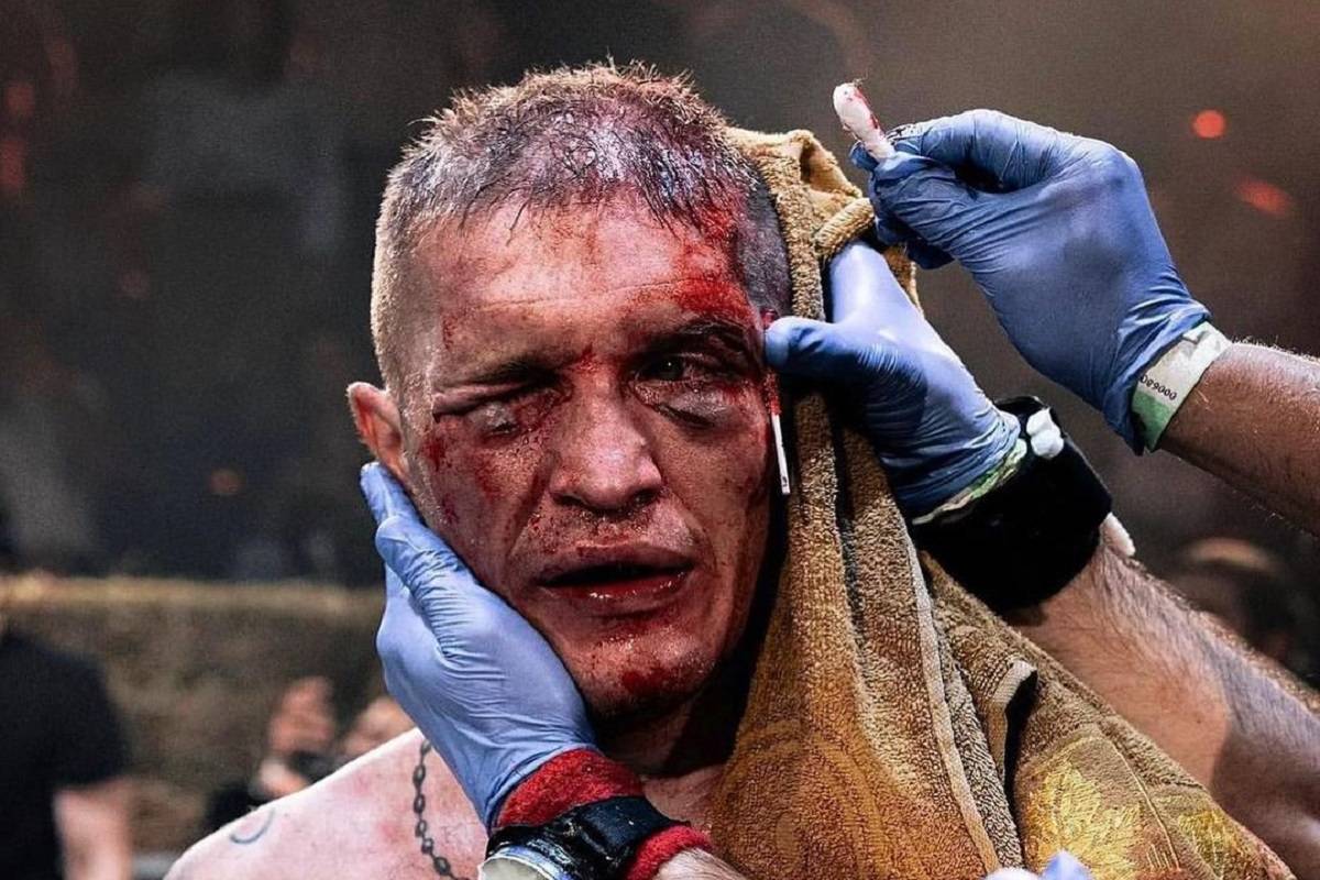 Єдиний українець в Bare Knuckle FC допоміг підрозділу ЗСУ