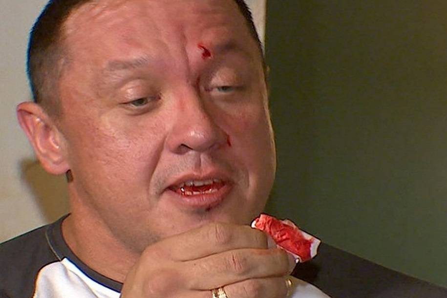 Емельяненко пустил кровь Кокляеву во время интервью