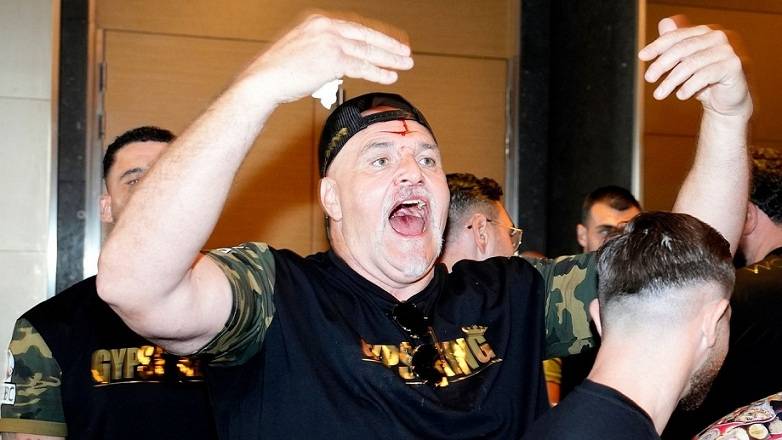 Ексчемпіон світу – про сутичку команд Усика та Ф'юрі: «Це огидно та ганебно»