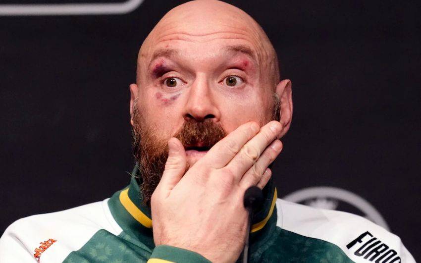 Колишній чемпіон світу назвав справжню причину виходу Ф'юрі на пенсію