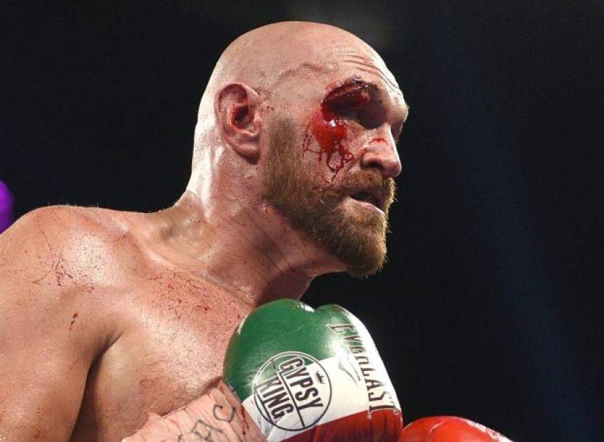 XSport image preview