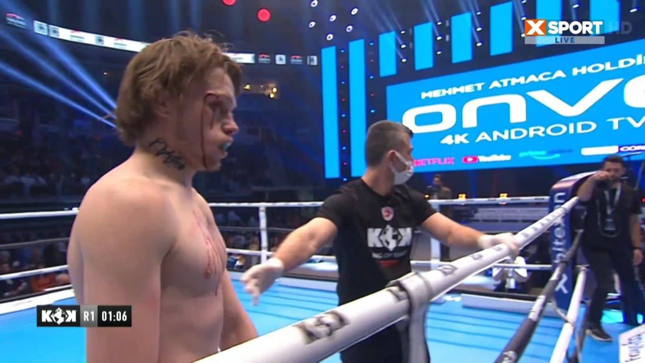 Український боєць пропустив страшний удар коліном у голову і програв бій в першому раунді