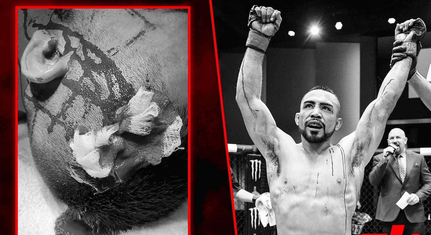 Жахливе видовище. Мексиканський боєць втратив 20% крові в переможному поєдинку на турнірі UFC Fight Night 216