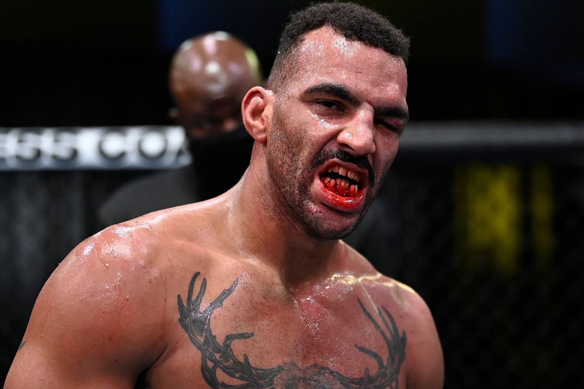Це фото вас шокує. Як виглядає щелепу бійця UFC, з якої той бився до кінця бою
