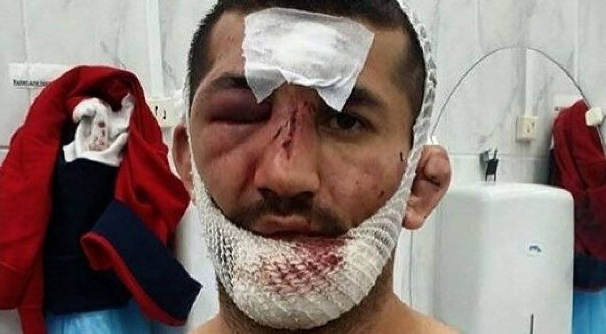 Уберите детей от экрана. Как «убивали» бойца, посмевшего критиковать Хабиба