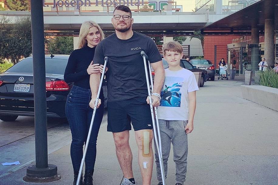 Последствия карьеры в MMA. Биспингу заменили колено на металлическое