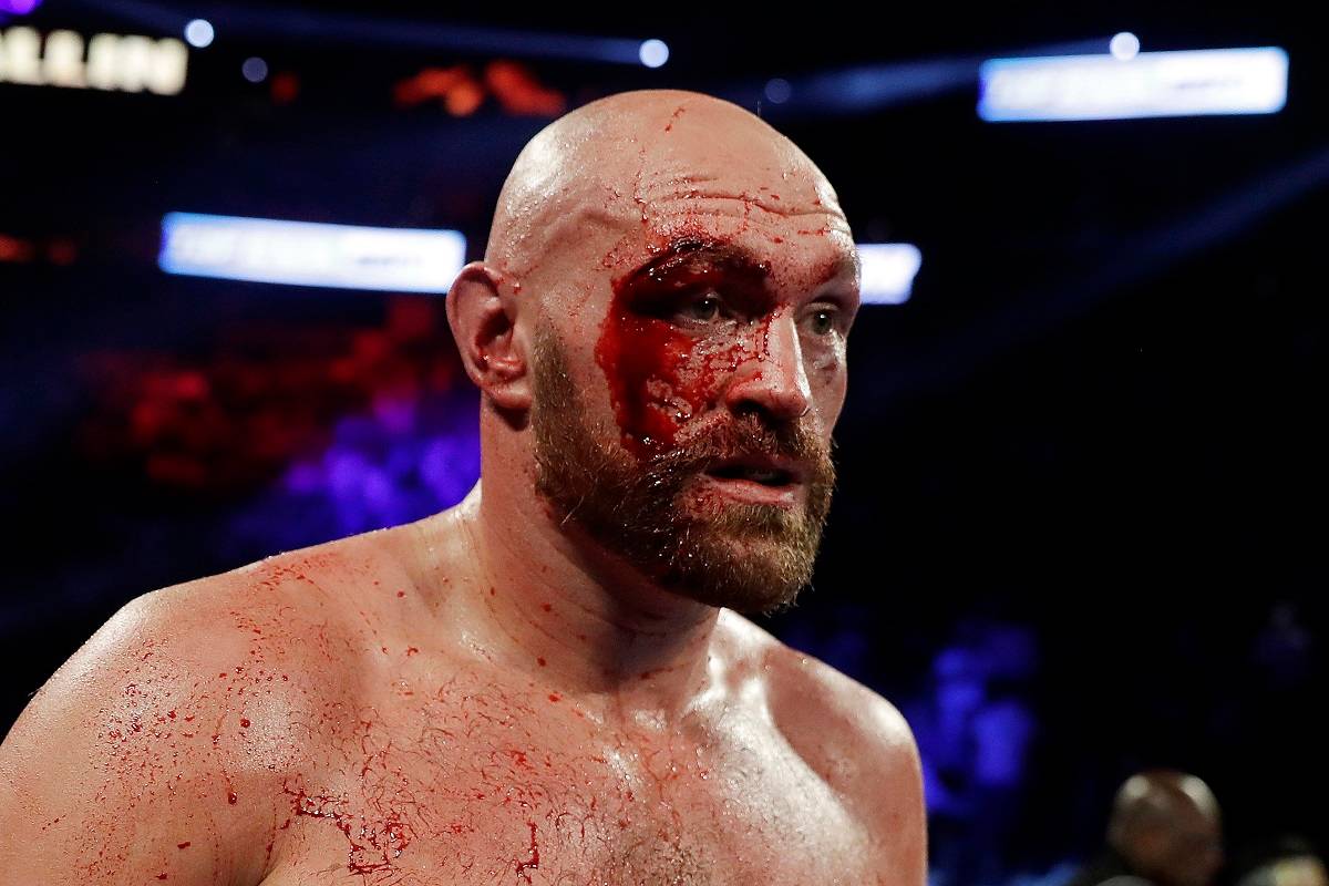 Фьюри намерен подписать контракт с UFC