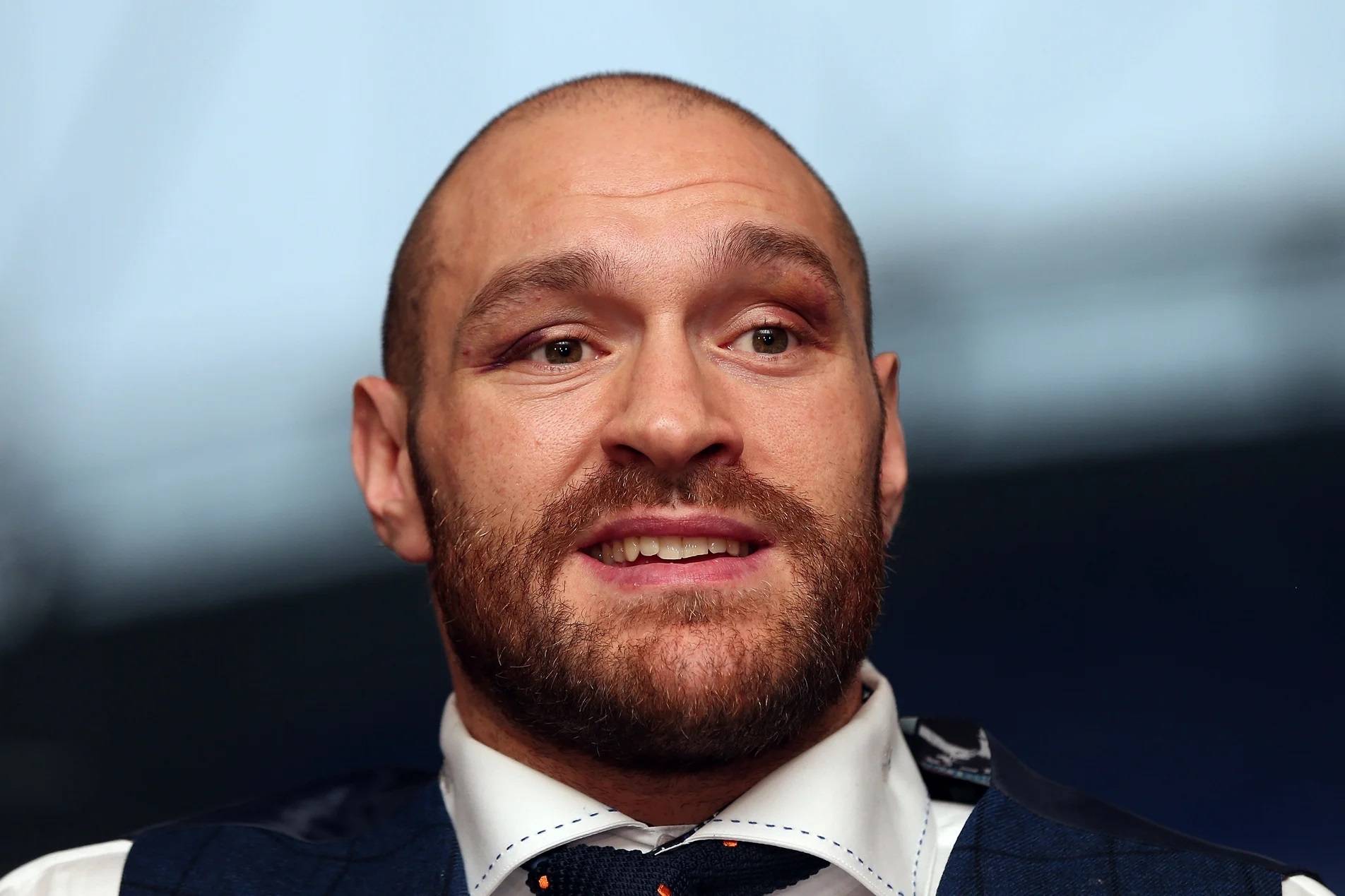 Ексчемпіон світу: «Ф'юрі не місце за головним столом з боксерами з Залу слави»