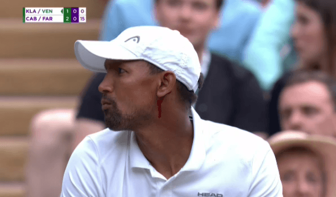 Полуфиналисту Wimbledon разбили голову мощным ударом