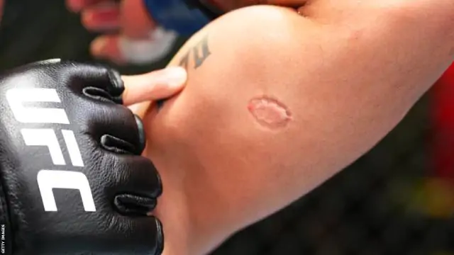 «Е*****й бонус». Бразильского бойца UFC дисквалифицировали за укус соперника