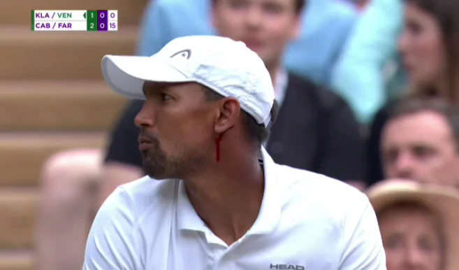 Полуфиналисту Wimbledon разбили голову мощным ударом